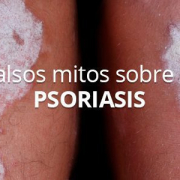 Falsos mitos sobre la psoriasis