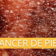 Fundación Piel Sana de la AEDV / El cáncer de piel