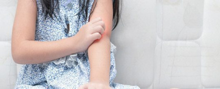 Psoriasis en la infancia... un reto de diagnóstico