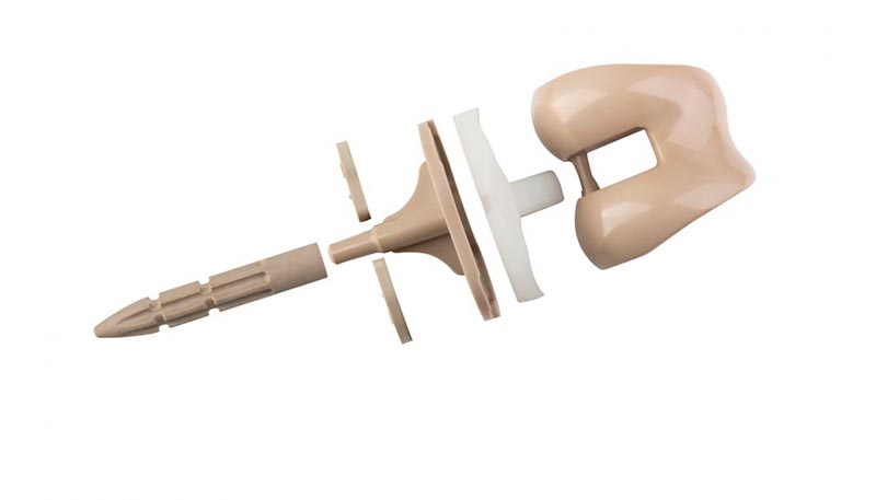 Un implante de rodilla fabricado íntegramente en polímero