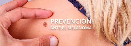 Aumentan los casos de cáncer de piel en España